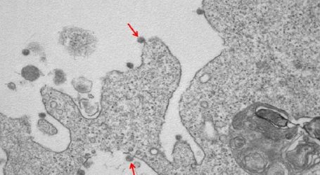 CORONAVIRUS – Aggiornamento del 2 aprile